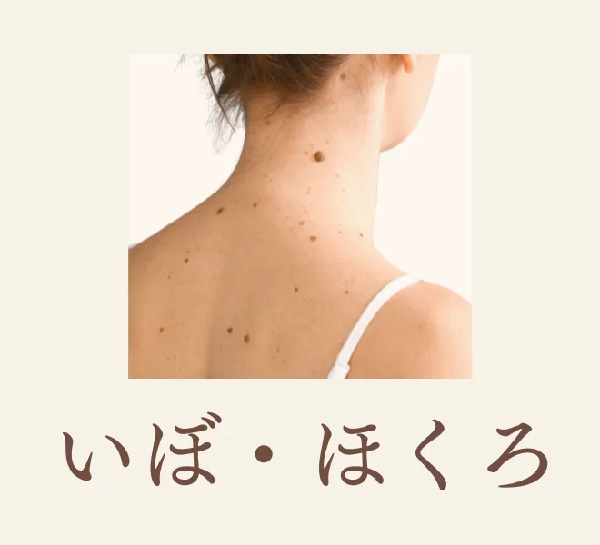 いぼ・ほくろ