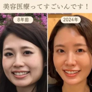 IMG_1180 美容医療ってすごいんです!