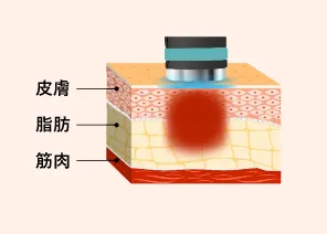 オンダプロの仕組み